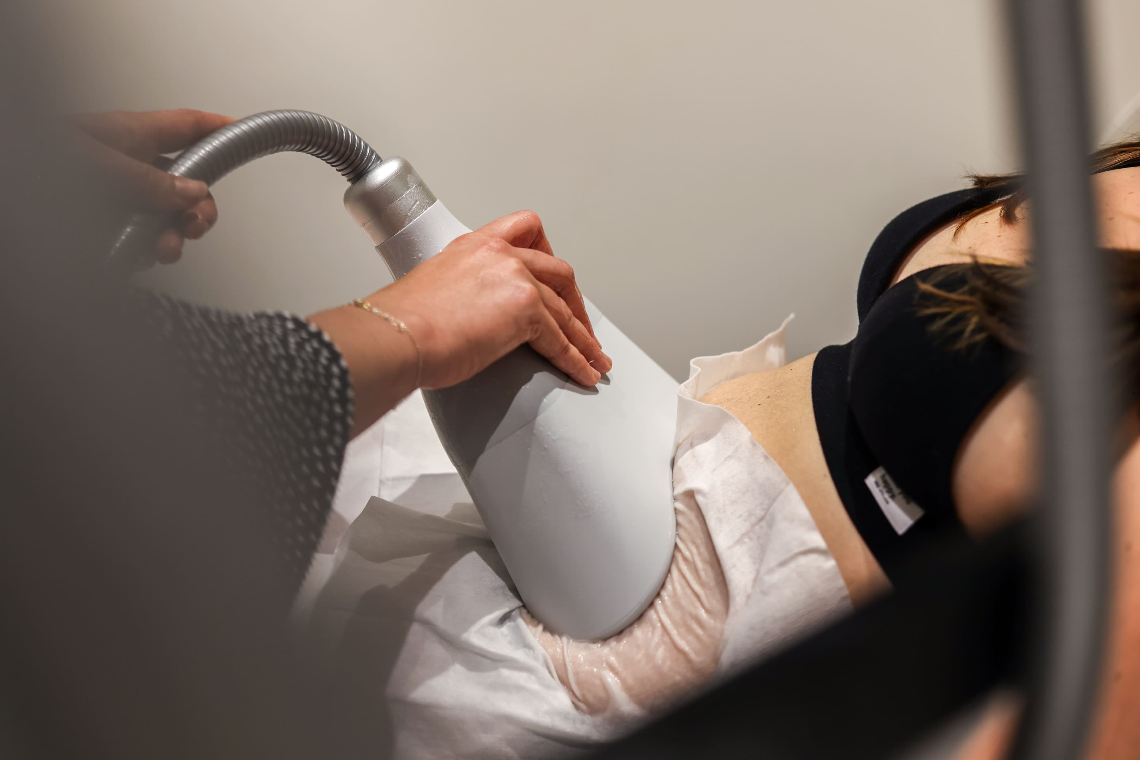 Illustration de l’article : Cryolipolyse : Comment Julie a retrouvé un ventre sculpté après sa grossesse