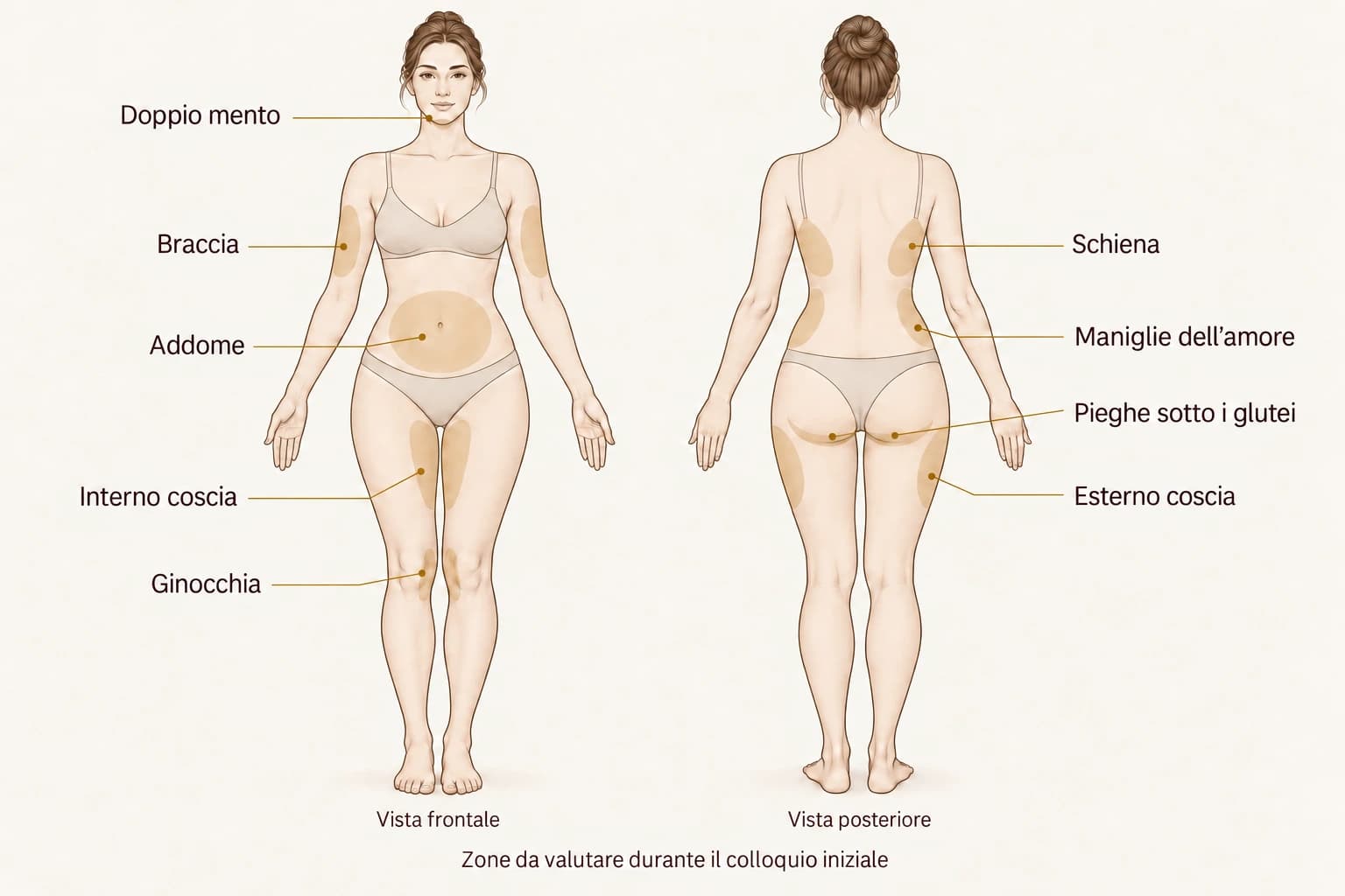 Schema delle zone da valutare: doppio mento, braccia, addome, schiena, maniglie dell’amore, cosce, pieghe sotto i glutei e ginocchia.